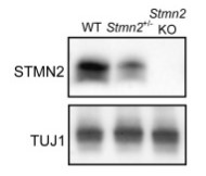 STMN2 protein in brain lysates.jpg